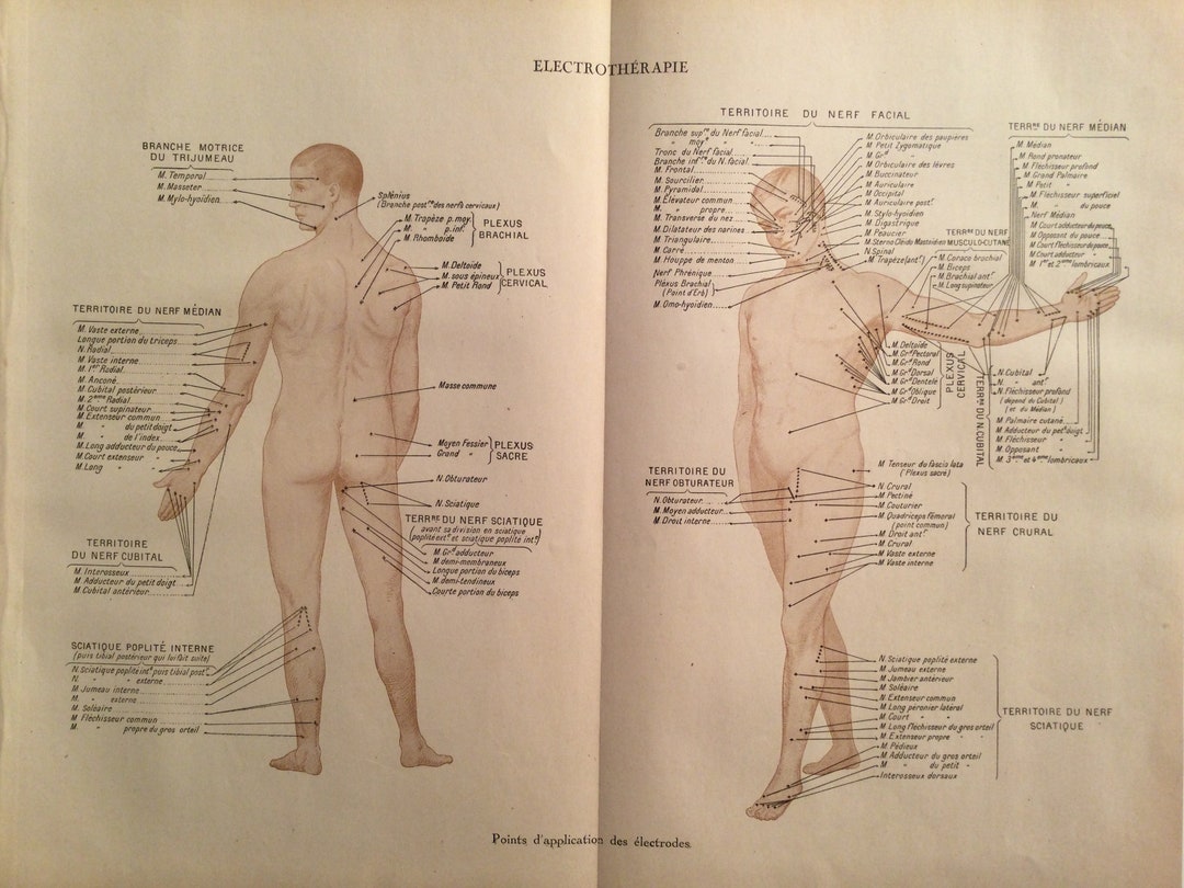 Electrotherapy, Electrodes, Nerves, Anatomy, Human Body, Large Format - Original Board- Old Illustration - Vintage Printing