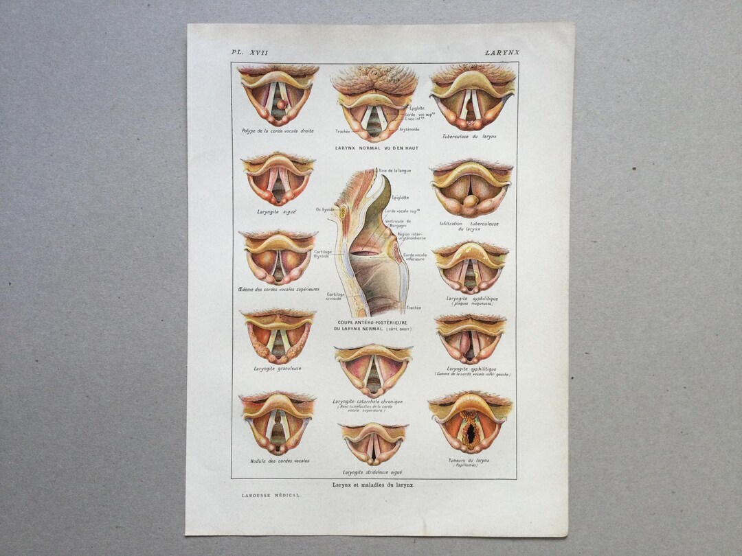 Larynx Anatomy, Larynx Diseases, Human Body - Vintage Nose Prints ...