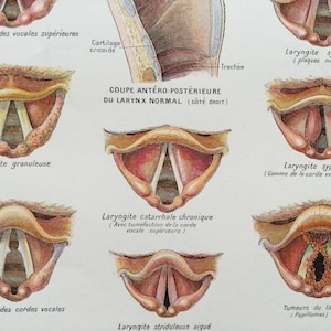 Larynx Anatomy of the larynx, Diseases of the larynx, Human Body - Human Body Anatomy Nose Vintage Prints - Science Anatomy - Vintage French