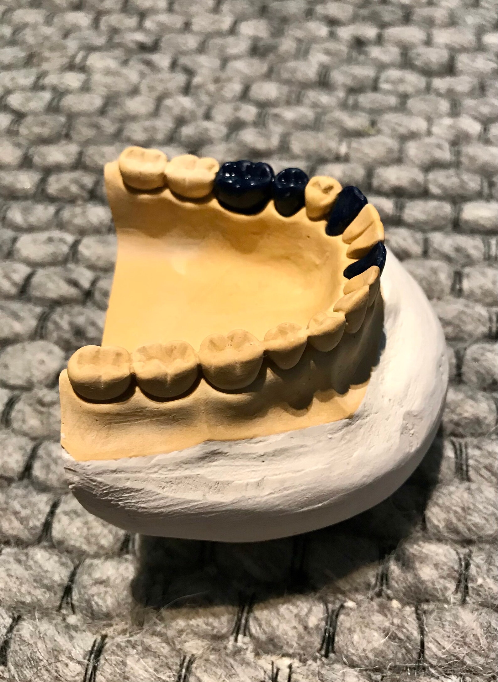 Vintage 1980s Plaster Dental Mold Anatomical Model Etsy