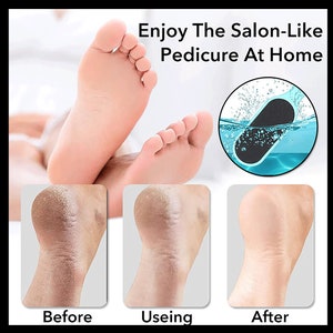 Foot File - Callus Remover Tool for Dead Skin Removal at Home Pedicure  Tools Foot Rasp Callus Remover Feet and Heels Smooth Soft Feet Using a  Grater & Scraper (Bamboo & Stainless