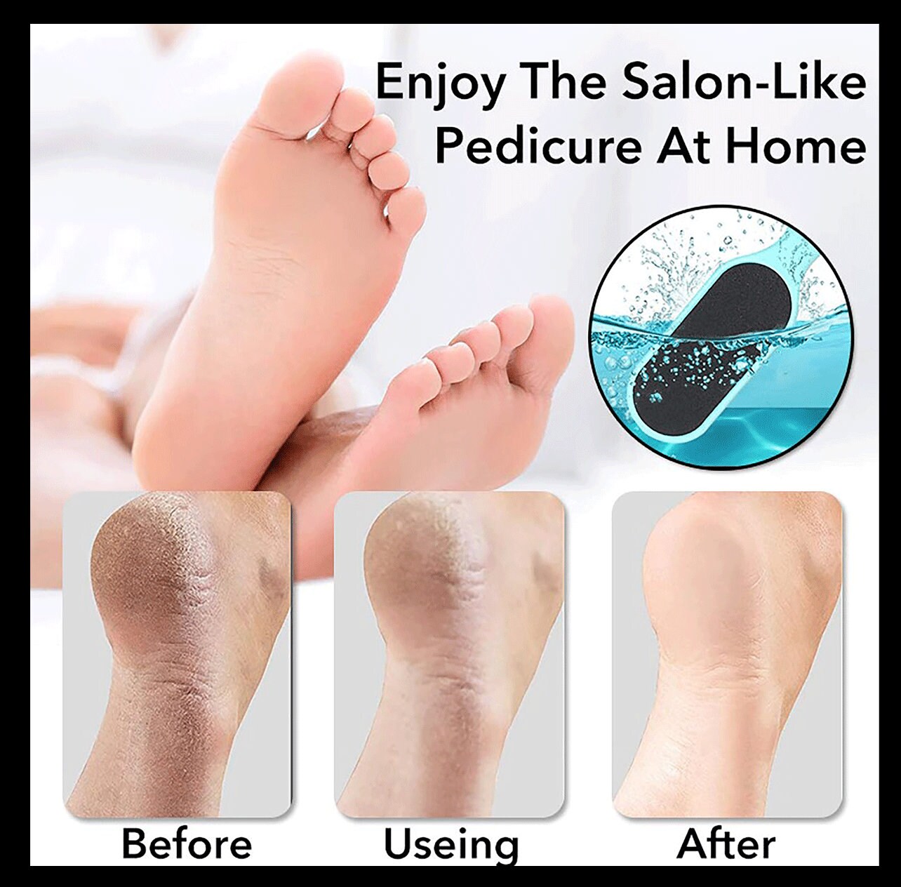 Foot Scraper Pedicure Supplies for Dead Skin Heel File Like Grater Calusses  Remover Feet Callus Shaver Feet Scrubber Hard Skin Kit with 10 Blade