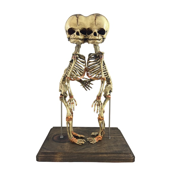 Cephalopagus Siamese Twin Conjoined Fetus Skeleton Three Eyed Fetal Gaff Oddity