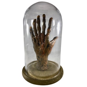 Bizarr! 6 Finger Mumifizierte Hand mit Jar Oddity Medizinischer Gaff Mumie