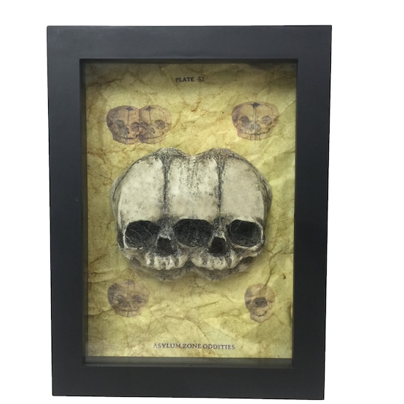Three Eyed Triclops Fetus Skull Medical Shadowbox Frame with Spiderwebs Two Headed Gaff