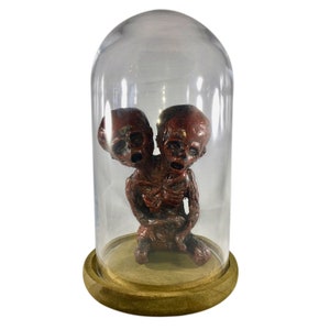 Deluxe Siamese Twin Conjoined Mummy Fetus with Bell Jar