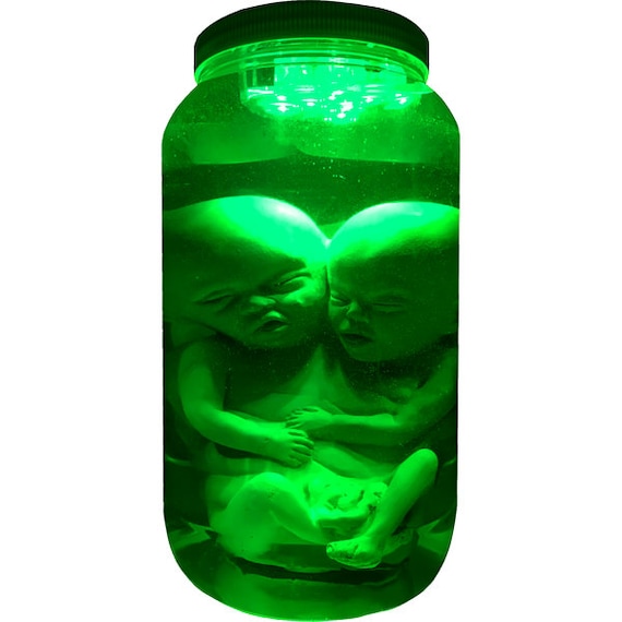 Plastic Formaldehyde Skin Siamese Twin Fetus Baby Fetal Specimen