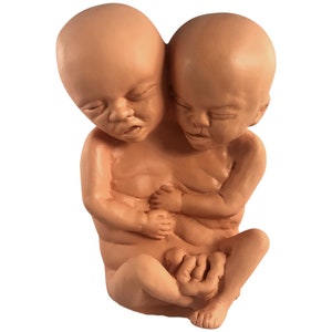 Peut inclure: Une sculpture en terre cuite de jumeaux siamois, l'un tenant l'autre. La sculpture est détaillée et réaliste, capturant les traits délicats des jumeaux.