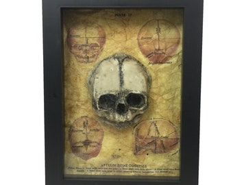 Fetus Skull Medical Shadowbox Frame with Spiderwebs Fetal Gaff Oddity