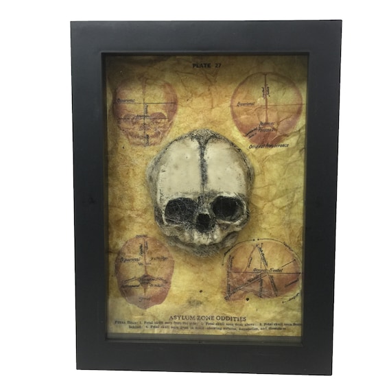 Fetus Skull Medical Shadowbox Frame with Spiderwebs Fetal Gaff Oddity