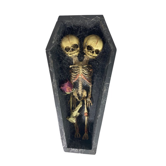 Deluxe Vintage Conjoined Siamese Twin Skeleton Fetus in Coffin Oddity
