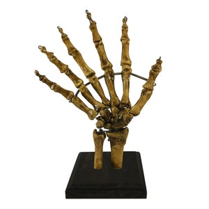 Bizarre! 6 Finger Skeleton Hand Oddity Medical Specimen