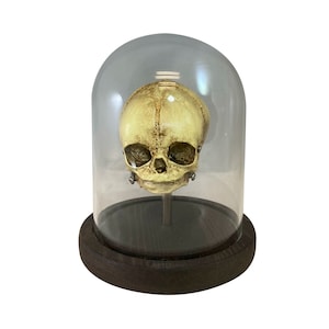 Fetus Skull with Glass Bell Jar Bell Jar Medical Specimen Oddity