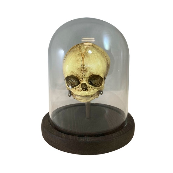 Fetus Skull with Glass Bell Jar Bell Jar Medical Specimen Oddity