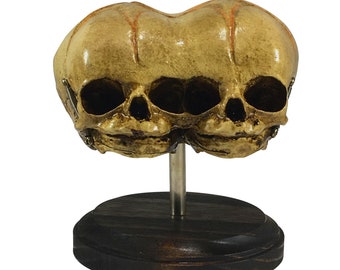 Triclops Siamese Twin 3-Eyed Skull on Display