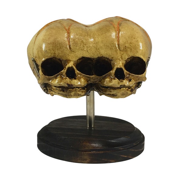 Triclops Siamese Twin 3-Eyed Skull on Display