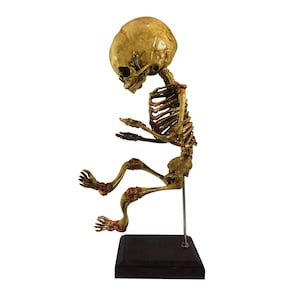 In Utero Sleeping Fetus Skeleton Oddity Medical Specimen Fetal Gaff