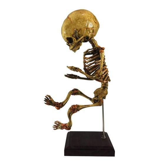 In Utero Sleeping Fetus Skeleton Oddity Medical Specimen Fetal Gaff