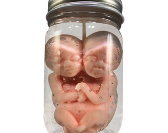 Specimen Siamese Twin Fetus Candle