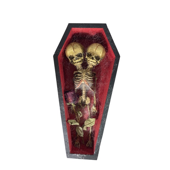 Deluxe Vintage Conjoined Siamese Twin Skeleton Fetus in Coffin Oddity
