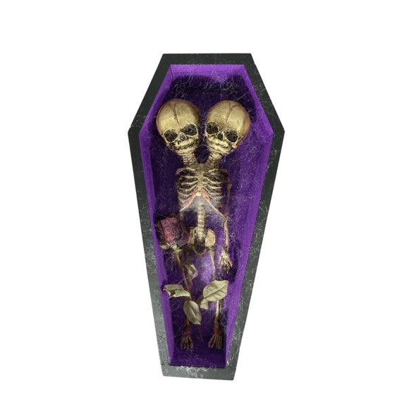 Deluxe Vintage Conjoined Siamese Twin Skeleton in Coffin Oddity