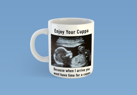 personalised baby scan