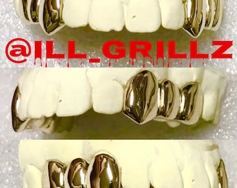 Handmade Custom 6pc Permanent Cut Dental Gold Grillz (K9’s and Premolars)