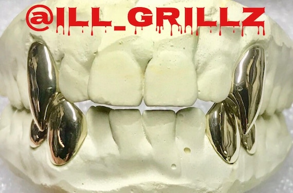 Handmade Custom Dental Gold Top Fangs With Bottom Wolf Style Grillz - Etsy  Canada