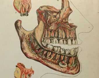 Original Medical, Anatomical, & Surgical Illustration Diseases of the Teeth, 7x9.5 inches, 1912, I.W. Wagner