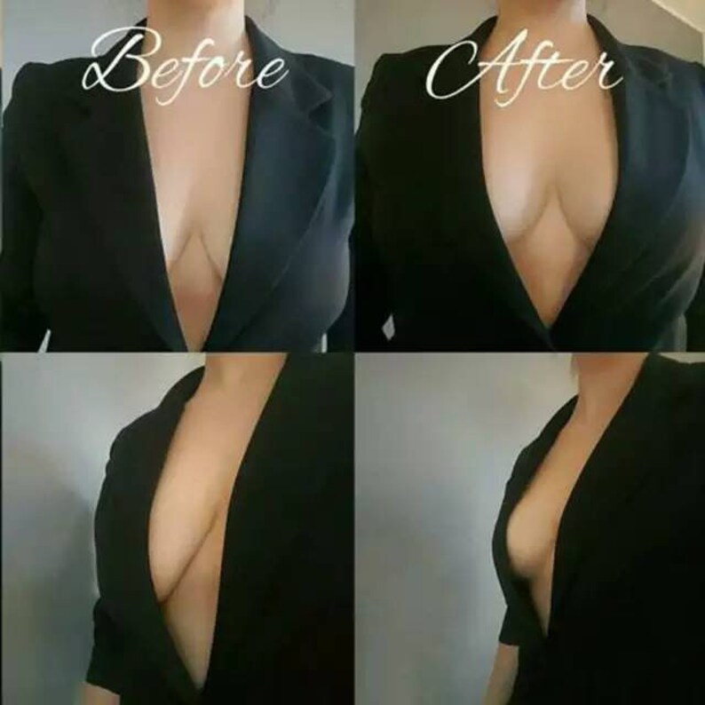 Adhesive Invisible Lifting Comfort Support Backless Tape Bra Black Color