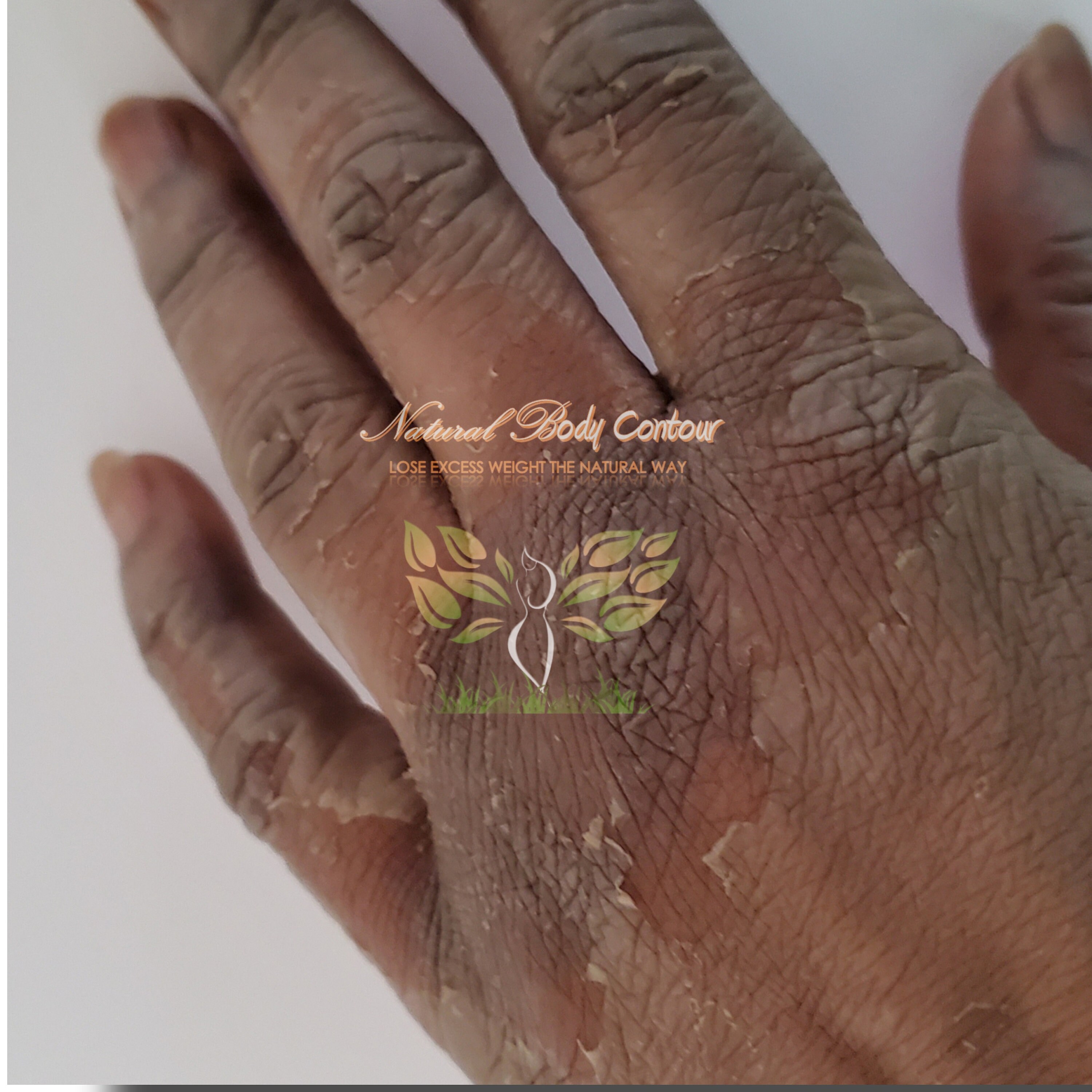 Dark Knuckle Treatment Cream Etsy UK