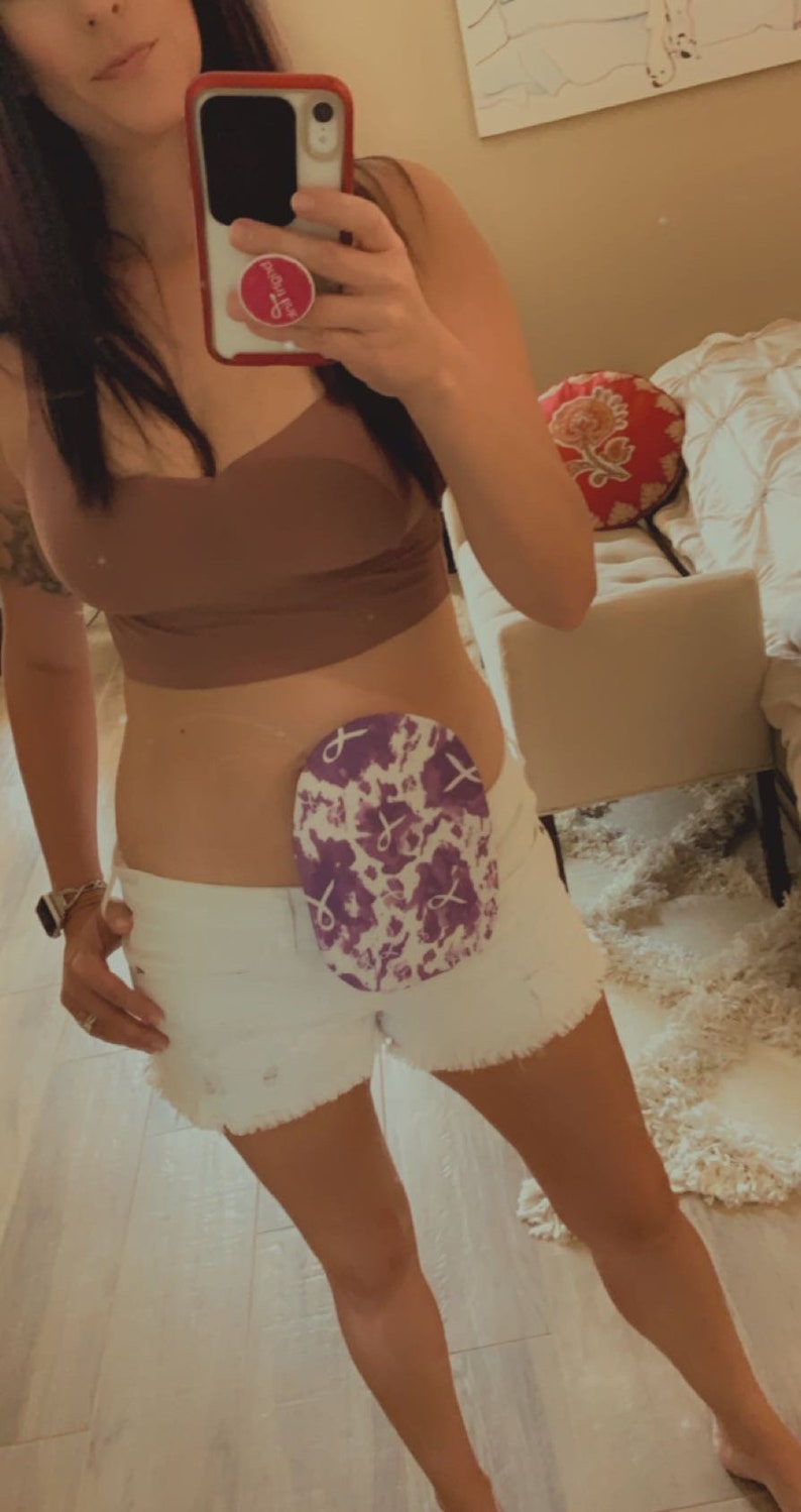 Crohn�s/Colitis Awareness Purple Ribbon Ostomy Bag Cover