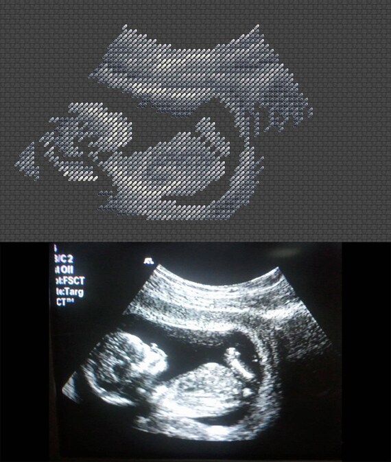 Custom hand embroider ultrasound Custom sonogram embroidery Personalized Embroidered ultrasound. Custom ultrasound embroidery