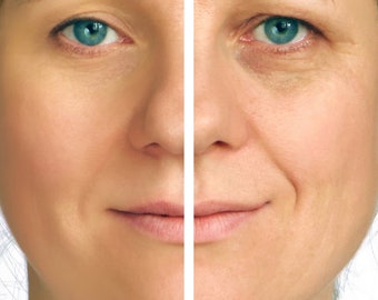 Argireline Peptidi amplificati, Acetyl Hexapeptide-8, attivo cosmetico anti-invecchiamento avanzato