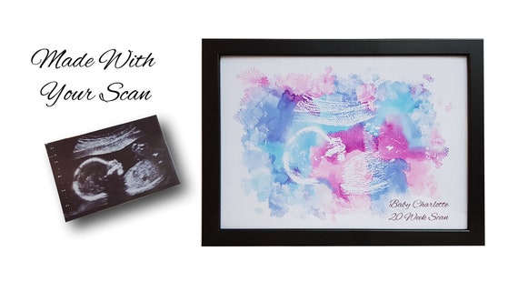 MUMMY TO BE GIFT Personalised Scan Photo Gift ***YOUR SCAN PHOTO PRINTED***