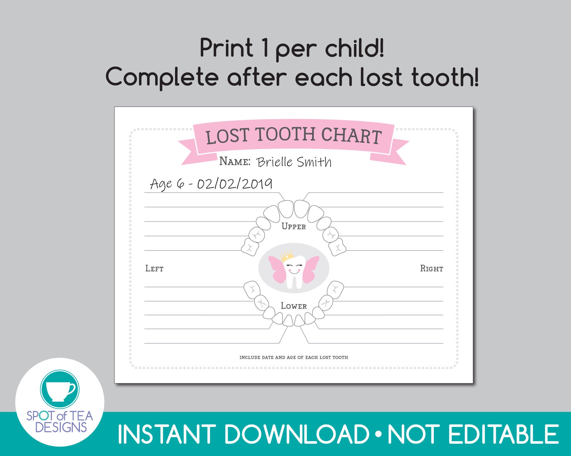 Tooth Fairy Kit Girl Tooth Fairy Printables Tooth Fairy Etsy