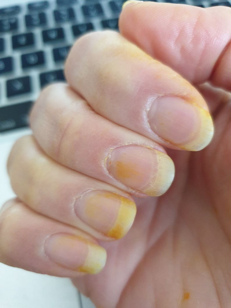 Beelotted Turmeric and Raw Honey Under Eye Cream Etsy