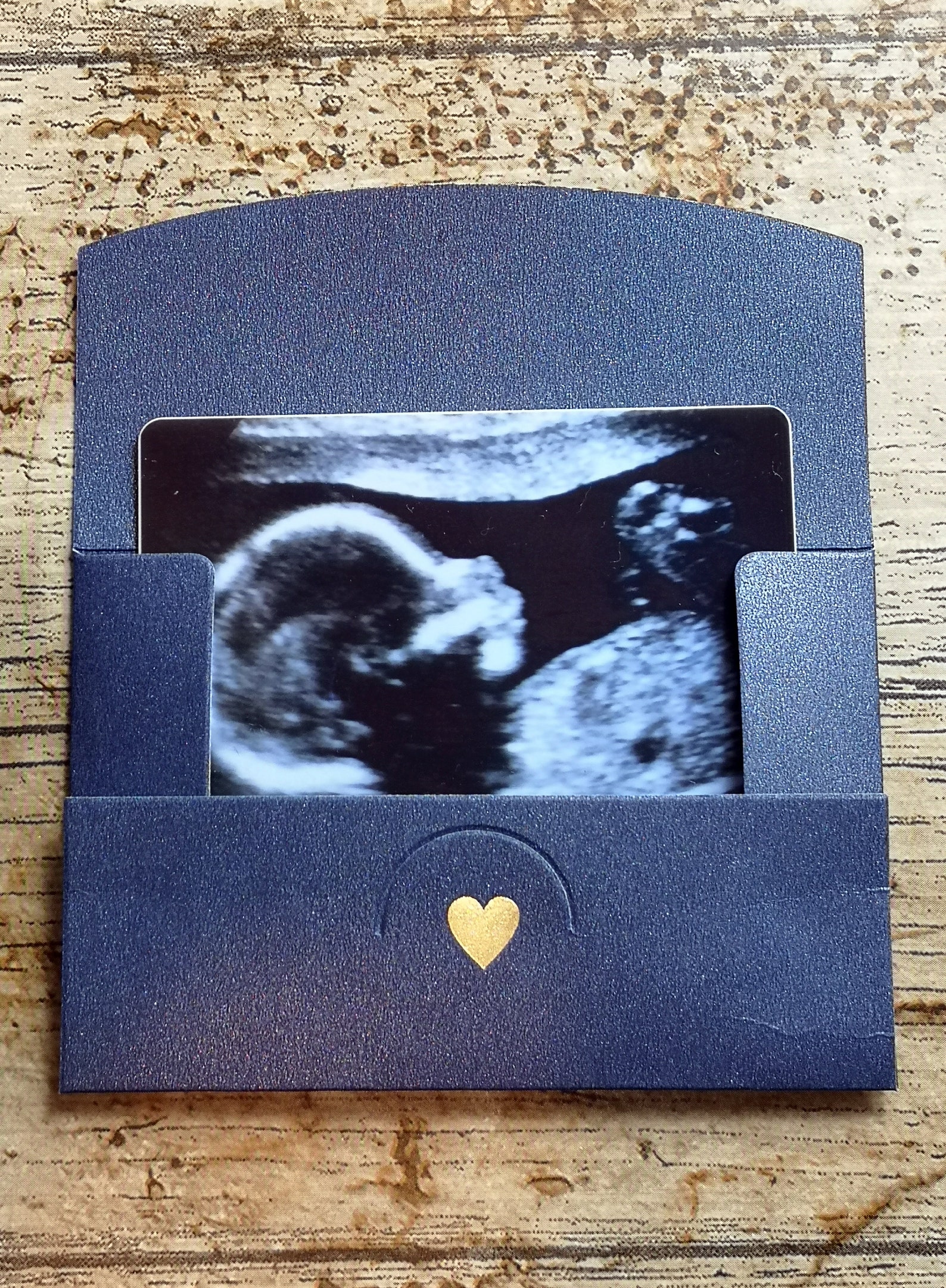 Personalised Baby Scan Photo With Gift Envelope Baby Scan Etsy