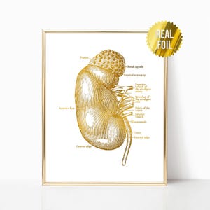 Kidney Transplant Anatomy Art Foil Print - Kidney Donor Gift - Urologist Nephrologist - Nurse Practitioner - Anatomical Kidney - Nephrology