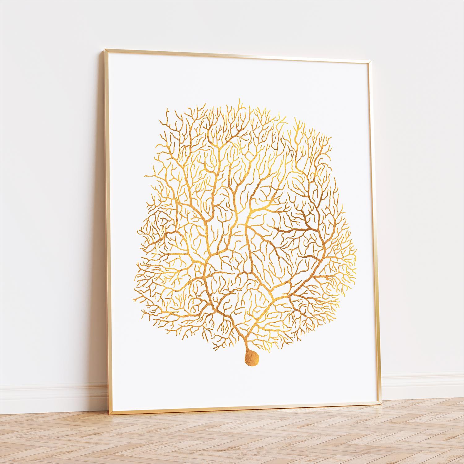 Neuroscience Brain Cell Art Foil Print - Purkinje Neuroscience Art ...