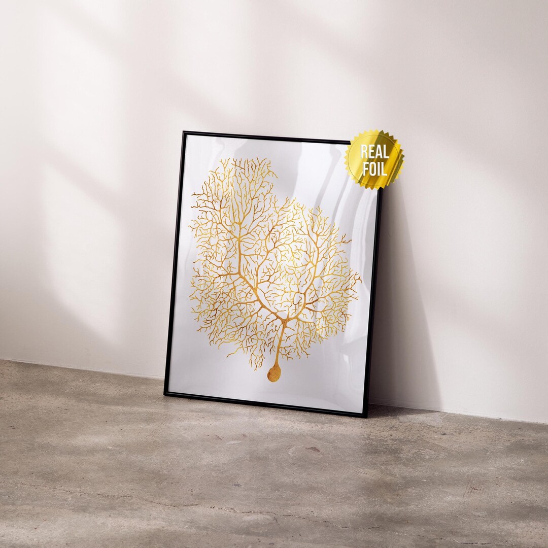 Neuron Anatomy Brain Art Foil Print - Neuroscience Classroom Decor ...