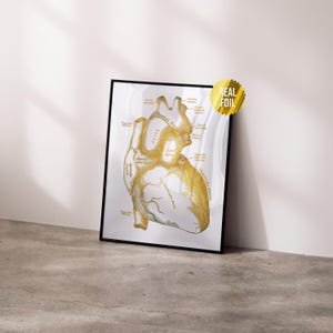 Anatomical Heart Foil Print - Physician Assistant Graduation Gifts - Cardiologist Medical Assistants - Nursing Student Anatomy Art