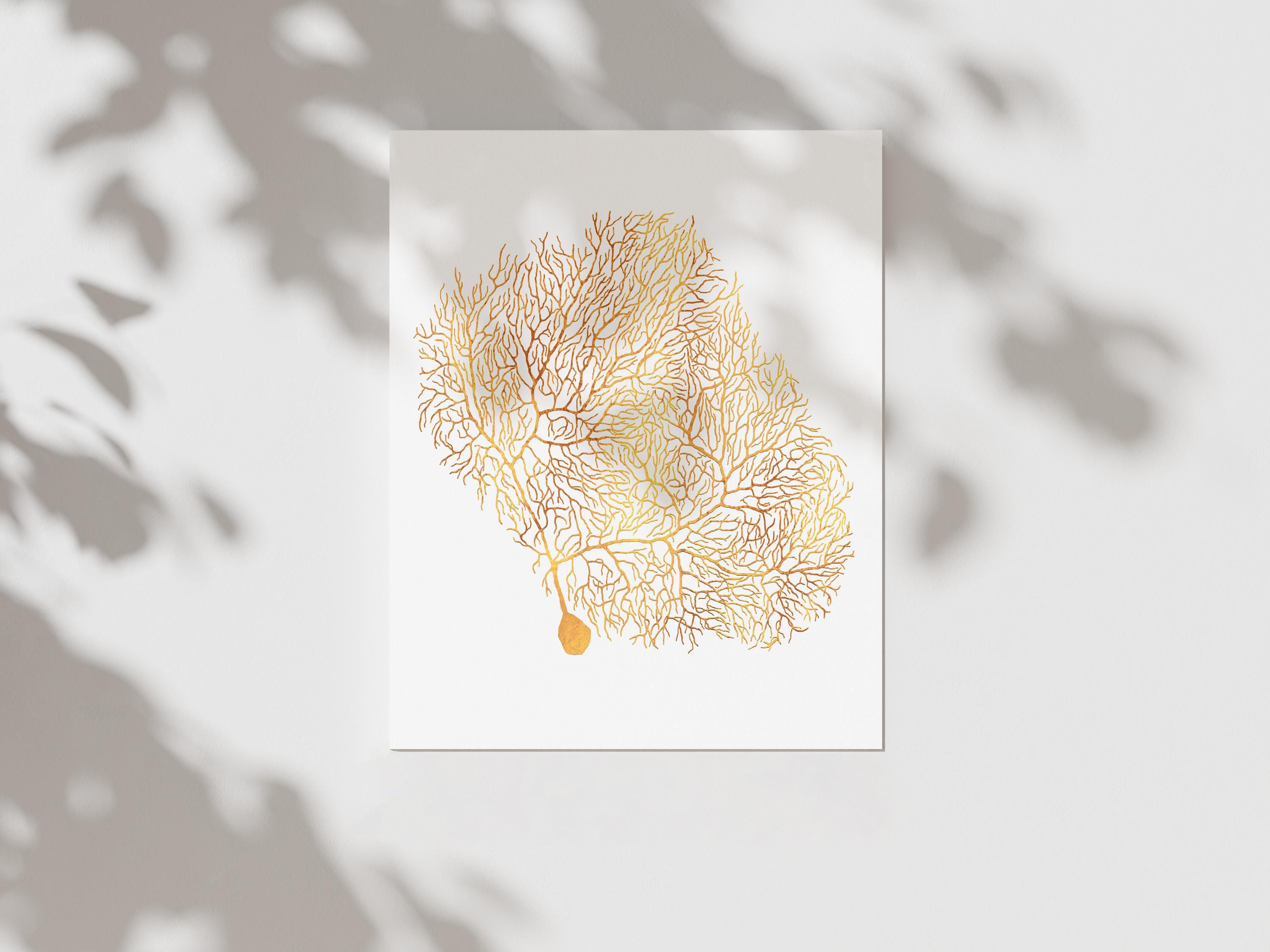 Purkinje Neuron Brain Art Foil Print - Occupational Therapy Wall Art ...
