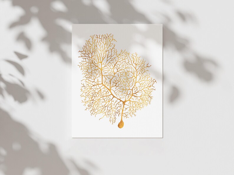 Neuron Anatomy Brain Art Foil Print - Neuroscience Classroom Decor ...