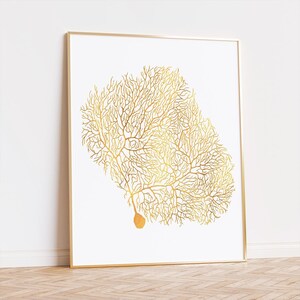 Purkinje Neuron Brain Art Foil Print - Occupational Therapy Wall Art ...