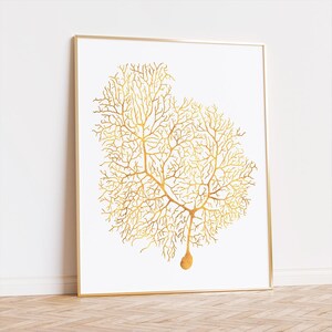 Neuron Anatomy Brain Art Foil Print - Neuroscience Classroom Decor ...