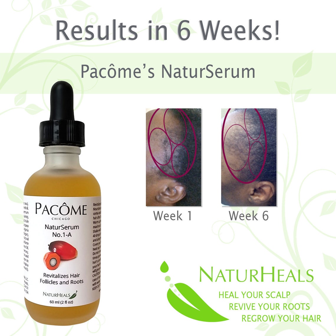 Natural Hair Growth Serum With Palm Kernel Shea Butter Etsy