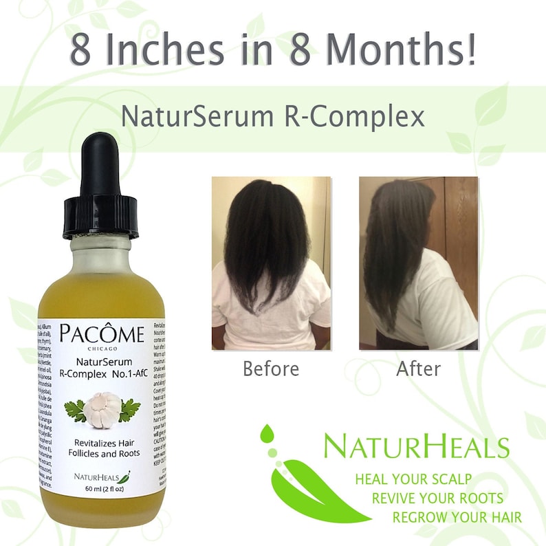 Stimulating Hair Growth Serum With Garlic Thyme Mint Etsy