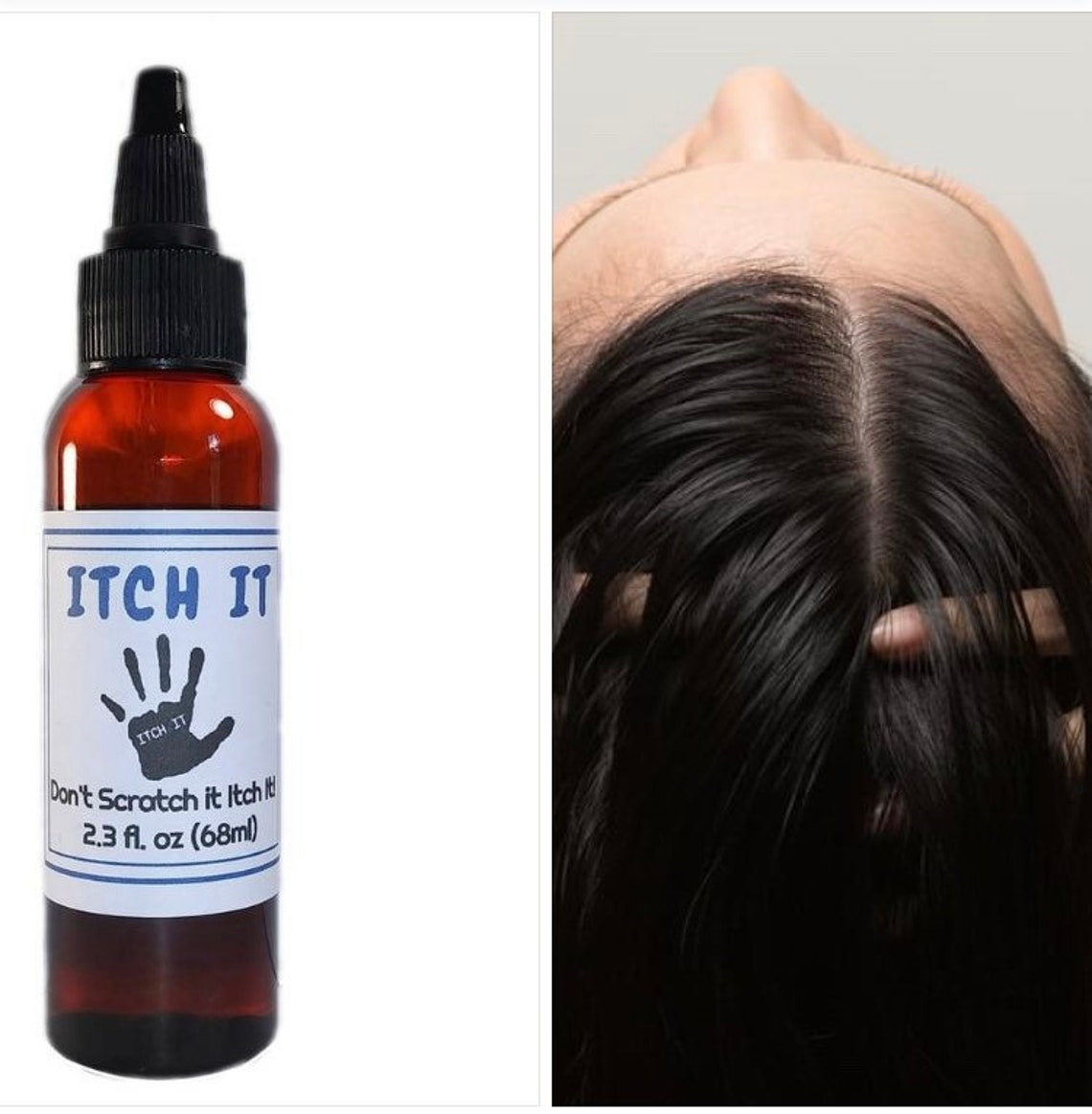 Best Oils for Itchy Scalp. Dry Scalp Oil Dry Scalp Relief. Etsy