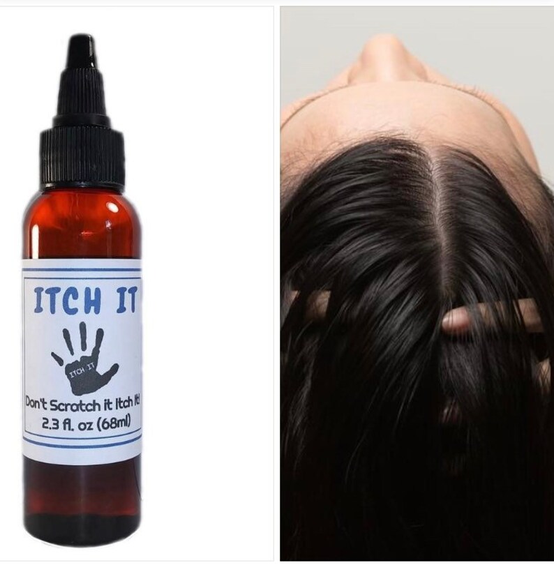 Best Oils for Itchy Scalp. Dry Scalp Oil Dry Scalp Relief. Etsy